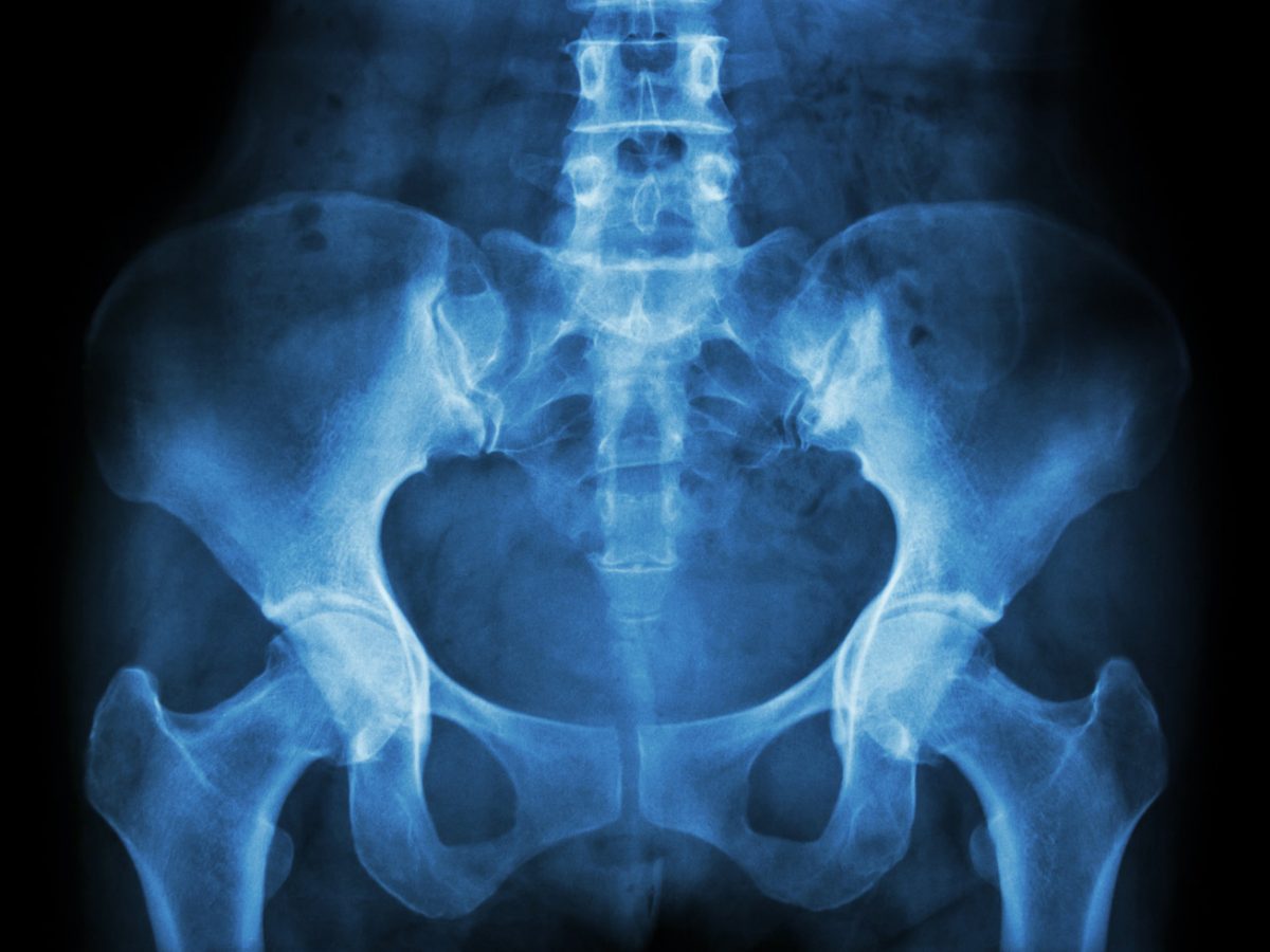 Understanding the Signs and Symptoms of Pelvic Prolapse